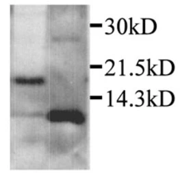 Anti-CXCL2 / GRO beta antibody used in Western Blot (WB). GTX29777