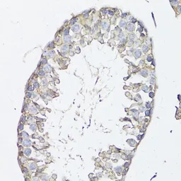 Anti-MRP4 antibody used in IHC (Paraffin sections) (IHC-P). GTX30016
