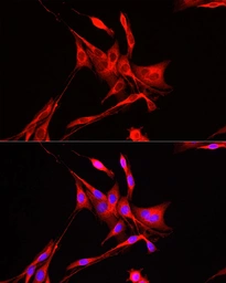 Anti-ADAM9 antibody used in Immunocytochemistry/ Immunofluorescence (ICC/IF). GTX30025