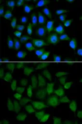 Anti-Alpha fetoprotein / AFP antibody used in Immunocytochemistry/ Immunofluorescence (ICC/IF). GTX30030