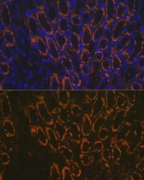 Anti-AMACR antibody used in IHC (Paraffin sections) (IHC-P). GTX30045