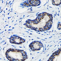 Anti-AMACR antibody used in IHC (Paraffin sections) (IHC-P). GTX30045