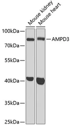 Anti-AMPD3 antibody used in Western Blot (WB). GTX30046