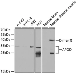 Anti-Apolipoprotein D antibody used in Western Blot (WB). GTX30058