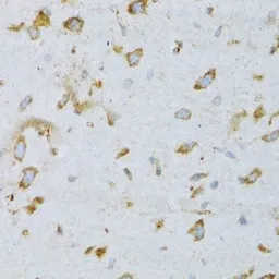 Anti-ARF6 antibody used in IHC (Paraffin sections) (IHC-P). GTX30062