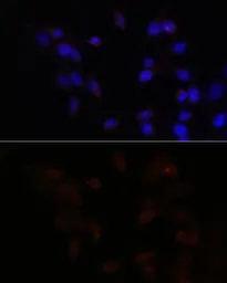 Anti-ATF4 antibody used in Immunocytochemistry/ Immunofluorescence (ICC/IF). GTX30070