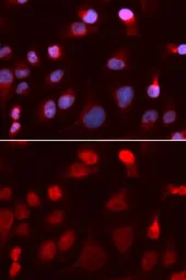 Anti-ATP7b antibody used in Immunocytochemistry/ Immunofluorescence (ICC/IF). GTX30077