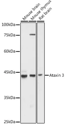 Anti-Ataxin 3 antibody used in Western Blot (WB). GTX30079
