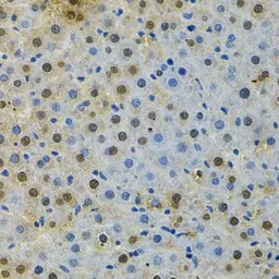 Anti-BUB1 antibody used in IHC (Paraffin sections) (IHC-P). GTX30097