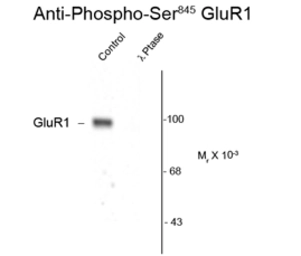 Anti-GluR1 (phospho Ser845) antibody used in Western Blot (WB). GTX30221
