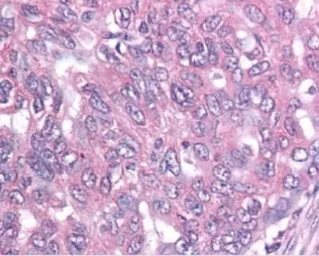 Anti-Survivin antibody [60.11] used in IHC (Paraffin sections) (IHC-P). GTX30241