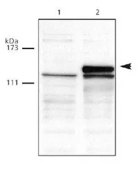 Anti-DNMT3A antibody used in Western Blot (WB). GTX30365