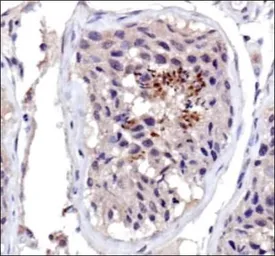 Anti-DNMT3A antibody used in IHC (Paraffin sections) (IHC-P). GTX30365
