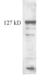 Anti-TERT antibody [2C4] used in Western Blot (WB). GTX30410
