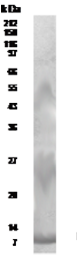 Anti-RELM beta antibody used in Western Blot (WB). GTX30435