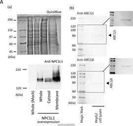 Anti-ABCG8 antibody used in Western Blot (WB). GTX30466
