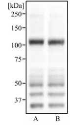Anti-ABCG1 antibody used in Western Blot (WB). GTX30598