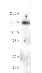 Anti-NPC1L1 antibody used in Western Blot (WB). GTX30599