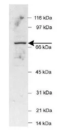 Anti-POT1 antibody used in Western Blot (WB). GTX30601