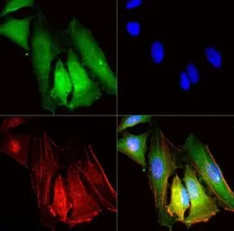 Anti-SR-BI + SR-BII antibody used in Immunocytochemistry/ Immunofluorescence (ICC/IF). GTX30630