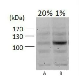 Anti-HIF1 alpha antibody used in Western Blot (WB). GTX30647