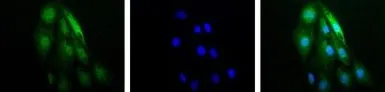 Anti-HIF1 alpha antibody used in Immunocytochemistry/ Immunofluorescence (ICC/IF). GTX30647