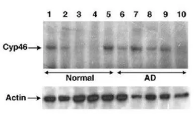 Anti-CYP46A1 antibody used in Western Blot (WB). GTX30682