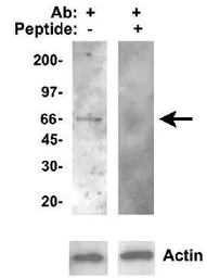 Anti-CYP46A1 antibody used in Western Blot (WB). GTX30682