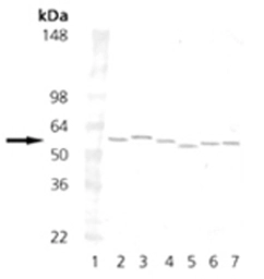 Anti-PDI antibody [1D3] used in Western Blot (WB). GTX30716