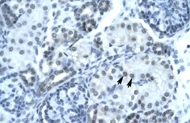 Anti-PAX2 antibody, Internal used in IHC (Paraffin sections) (IHC-P). GTX30760