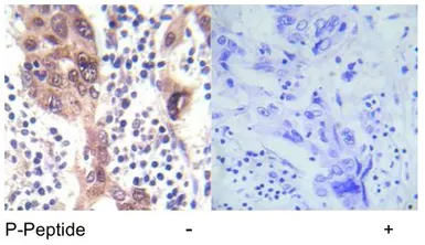 Anti-LKB1 (phospho Ser428) antibody used in IHC (Paraffin sections) (IHC-P). GTX30765
