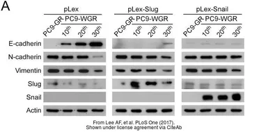 Anti-SLUG antibody used in Western Blot (WB). GTX30813