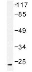 Anti-Ephrin A2 antibody used in Western Blot (WB). GTX30999