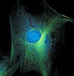 Anti-alpha Tubulin antibody [236-10501] used in Immunocytochemistry/ Immunofluorescence (ICC/IF). GTX31126