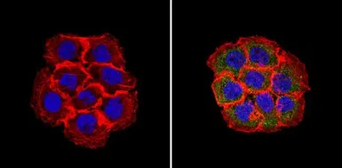 Anti-RhoA + RhoB + RhoC antibody [1A11-4G10] used in Immunocytochemistry/ Immunofluorescence (ICC/IF). GTX31128