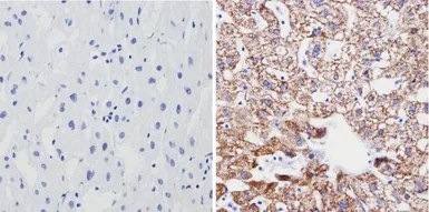 Anti-SOD2 antibody [1H6] used in IHC (Paraffin sections) (IHC-P). GTX31147