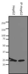 Anti-SOD2 antibody [1H6] used in Immunoprecipitation (IP). GTX31147