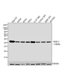 Anti-SOD2 antibody [1H6] used in Western Blot (WB). GTX31147