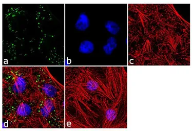Anti-SOD2 antibody [1H6] used in Immunocytochemistry/ Immunofluorescence (ICC/IF). GTX31147
