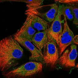 Anti-SCF antibody used in Immunocytochemistry/ Immunofluorescence (ICC/IF). GTX31189