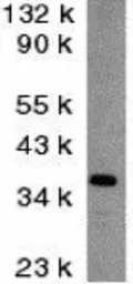 Anti-DFFB antibody used in Western Blot (WB). GTX31257