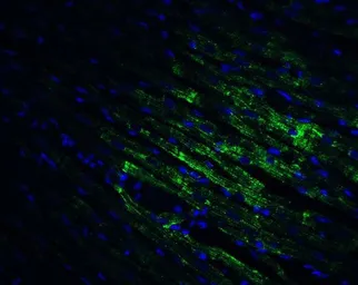 Anti-CX3CR1 antibody used in IHC (Paraffin sections) (IHC-P). GTX31260