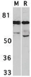 Anti-IRAK3 antibody used in Western Blot (WB). GTX31265