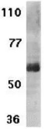 Anti-IL21 Receptor antibody used in Western Blot (WB). GTX31271