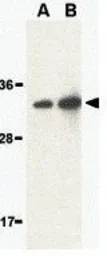 Anti-ALS2CR2 antibody used in Western Blot (WB). GTX31282