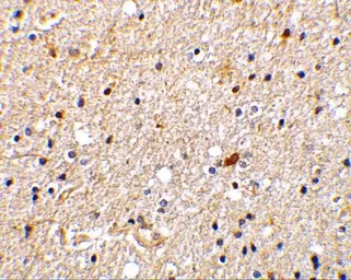 Anti-NADE antibody used in IHC (Paraffin sections) (IHC-P). GTX31283