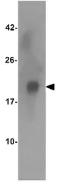 Anti-TNFRSF14 antibody used in Western Blot (WB). GTX31297