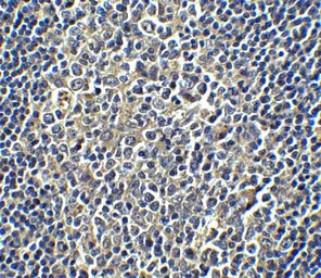Anti-PD-L1 antibody used in IHC (Paraffin sections) (IHC-P). GTX31308