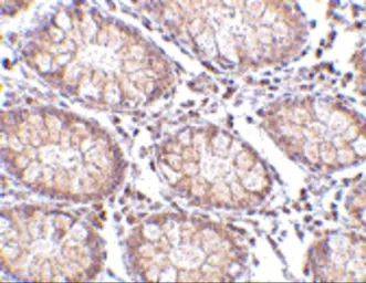 Anti-CCK4 antibody used in IHC (Paraffin sections) (IHC-P). GTX31322