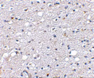 Anti-SIRT2 antibody used in IHC (Paraffin sections) (IHC-P). GTX31336